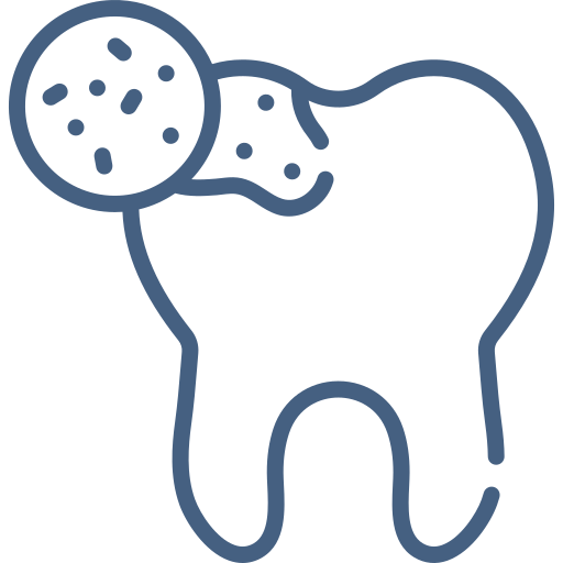 dental-caries