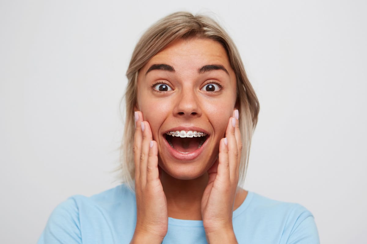 Tipos de brackets utilizados en ortodoncia Clinica Torrelaguna